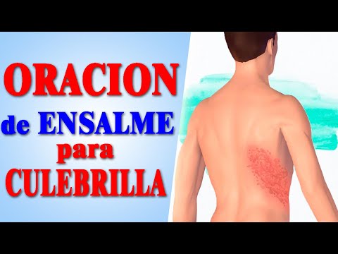 Oración para curar el herpes zoster